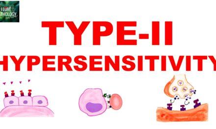 Type II Hypersensitivity