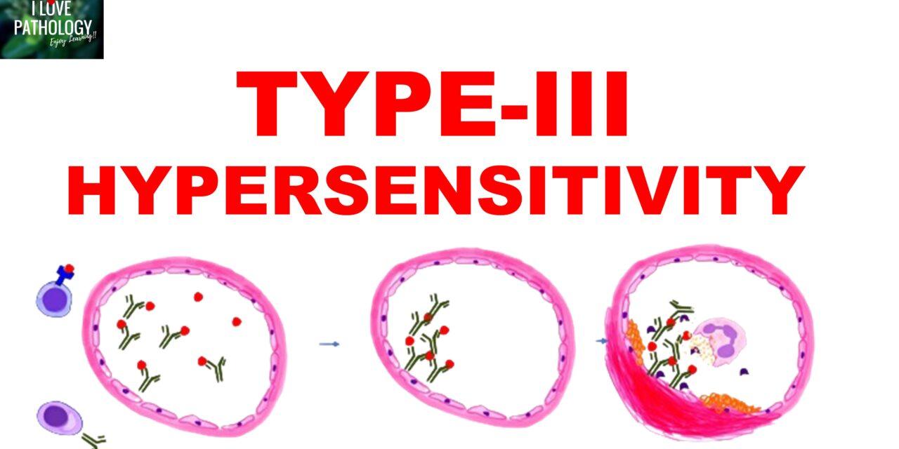 Type III hypersensitivity