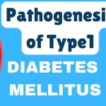 Pathogenesis of Type-1 Diabetes Mellitus