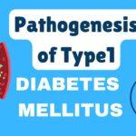 Pathogenesis of Type-1 Diabetes Mellitus