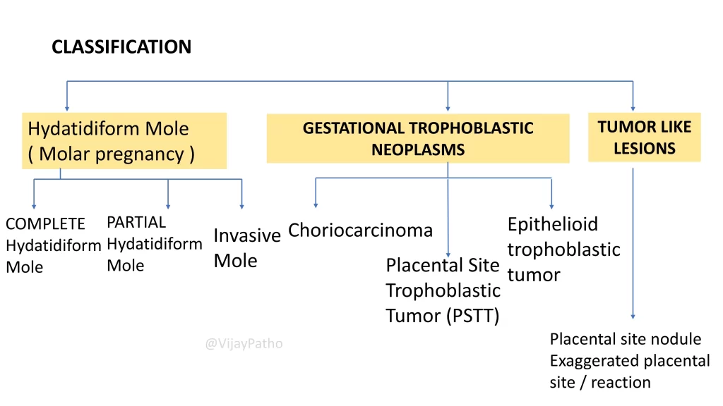 Classification of gestational trophoblastic diseases