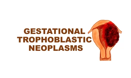 Gestational Trophoblastic Diseases: Part 2: Invasive mole., Choriocarcinoma, Placental site trophoblastic tumor