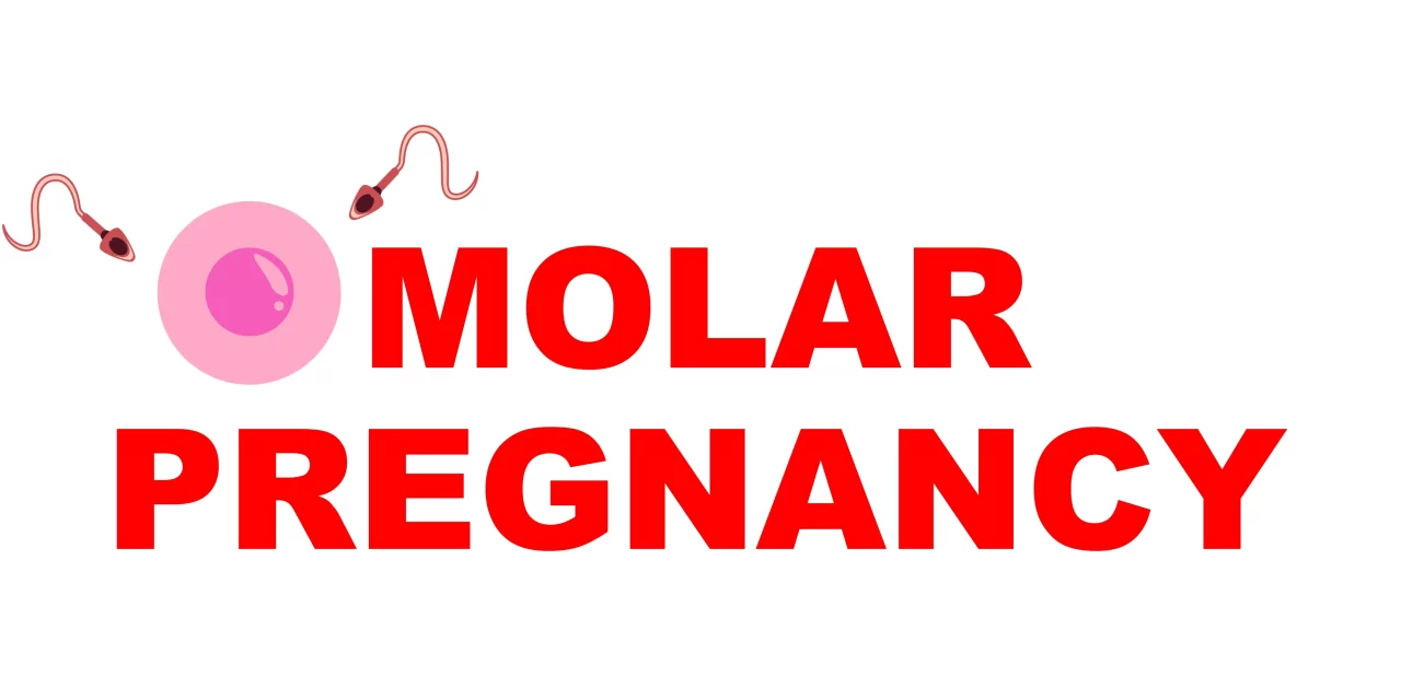 Gestational Trophoblastic Diseases: Part 1: Complete and Partial Hydatidiform Moles