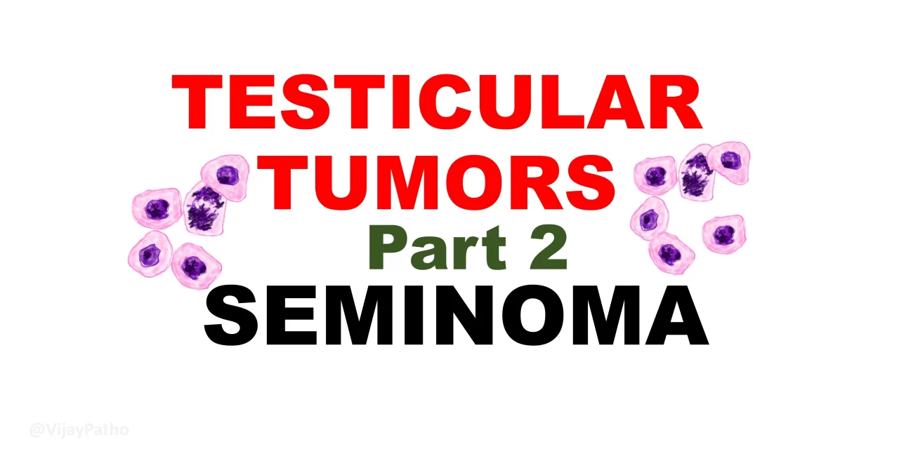 Seminoma:  Pathogenesis, clinical features and morphology