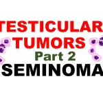 Seminoma