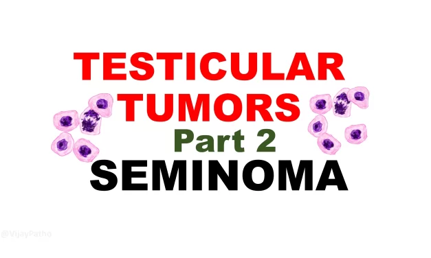 Seminoma:  Pathogenesis, clinical features and morphology