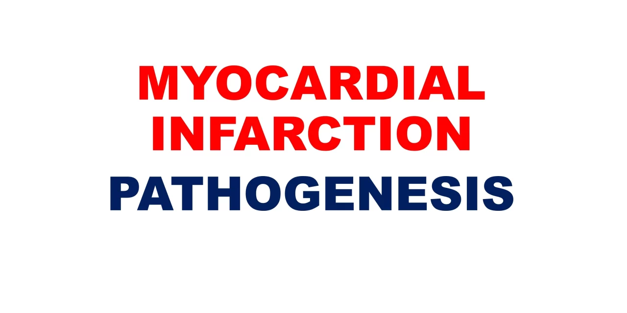 Myocardial Infarction: Pathogenesis and Infarct Types