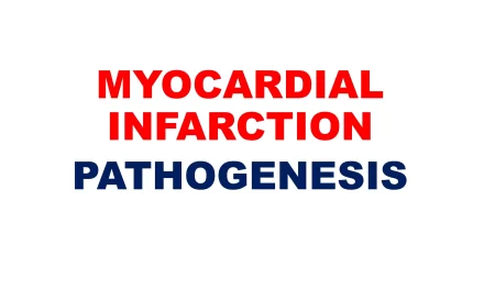 Myocardial Infarction: Pathogenesis and Infarct Types