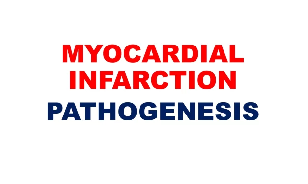 Myocardial Infarction: Pathogenesis and Infarct Types