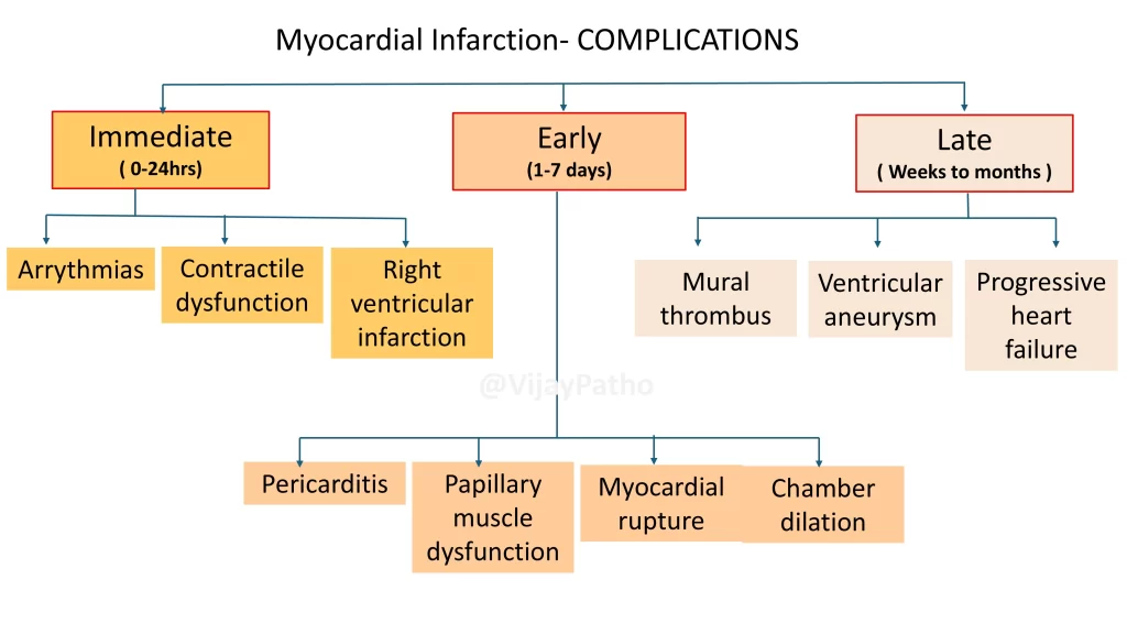 Myocardial infarctions - complications