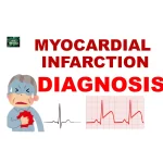 Clinical features of myocardial infarction