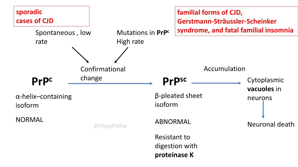 prion disease