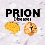 prion diseases