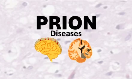 PRION DISEASES