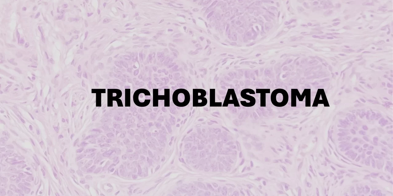 Pathology of Trichoblastoma