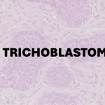 Trichoblastoma