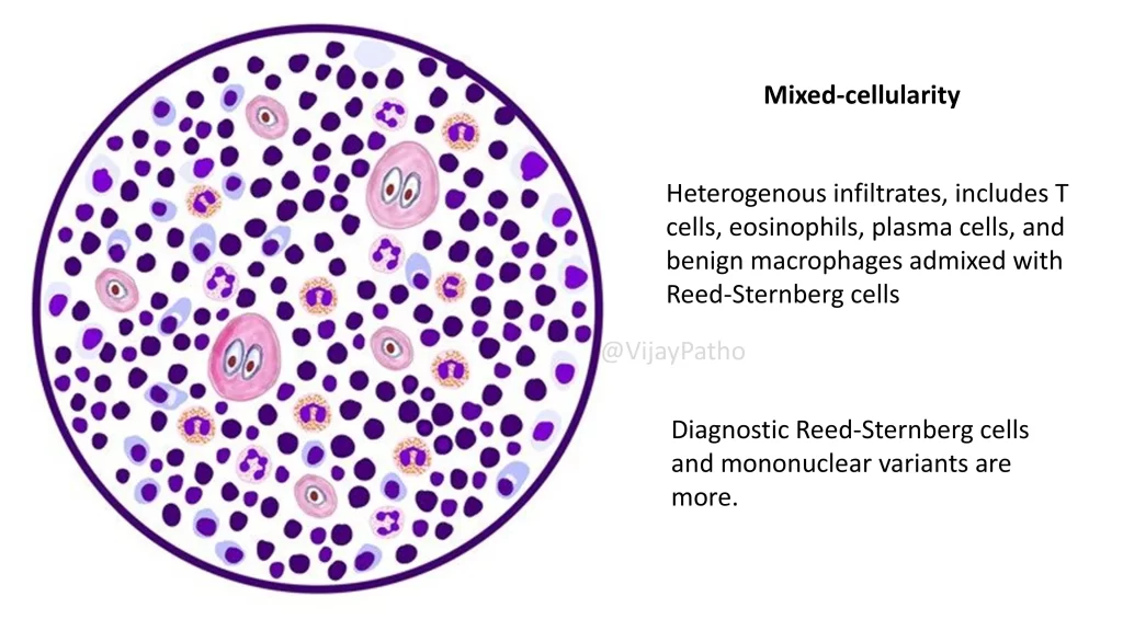 Hodgkin Lymphoma