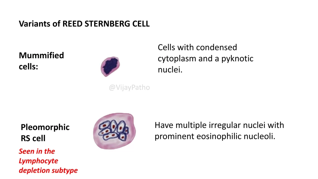 Reed Sternberg Cell