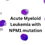 acute-myeloid-leukemia-with-npm1-mutation/