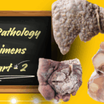 Gross Pathology Specimens