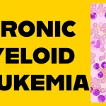 CML