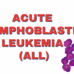 Acute Lymphoblastic Leukemia