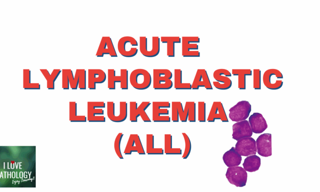 Acute Lymphoblastic Leukemia (ALL) – Simplified 