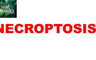 Necroptosis – Understanding a Programmed Necrosis Pathway