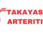 takayasu arteritis