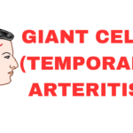 GIANT CELL ARTERITIS
