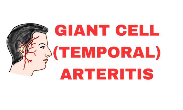 Giant Cell Arteritis (Temporal Arteritis): Pathogenesis, Pathology and Clinical Features