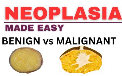 Benign vs Malignant Tumors