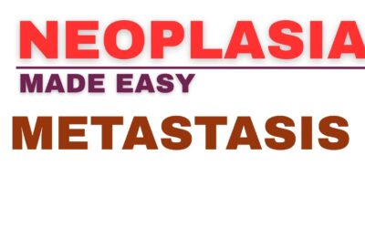 Metastasis