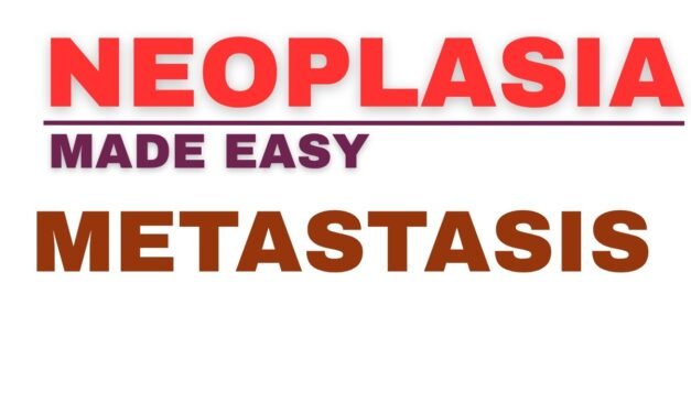 Metastasis